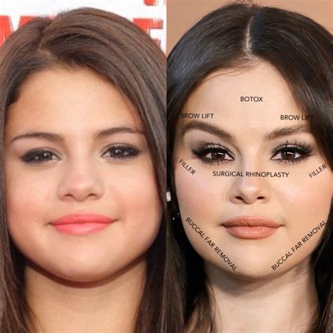 selena gomez boobs before and after|Selena Gomez shows off different faces after。